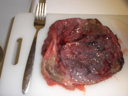 Comer placenta