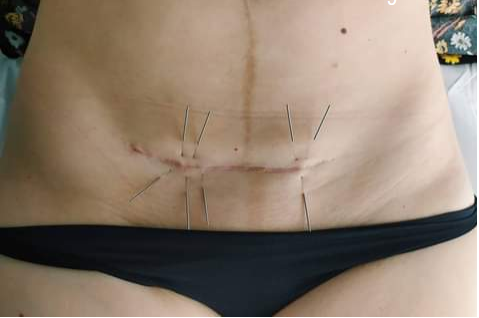 responsive_variations